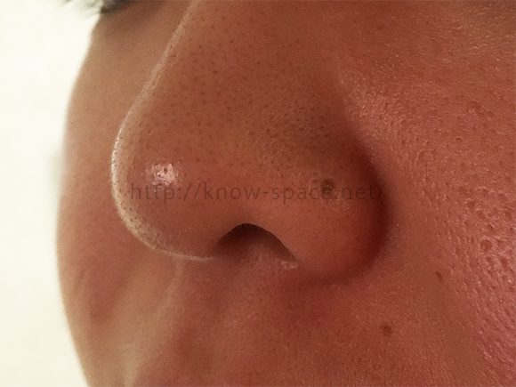ニベアクリームでいちご鼻が治る 毛穴汚れは取れるのか徹底検証